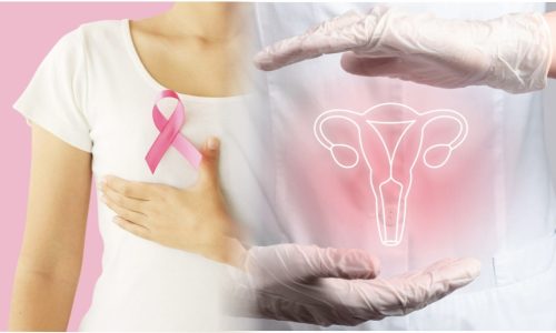 2-Curso-Manejo Integral del Cáncer de Mama y Cuello Uterino-Febrero-2025[1]