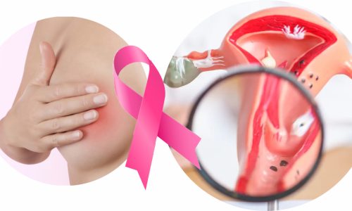 3-Curso-Prevención,_Diag_y_Tratamiento_de_Cáncer_de_Cuello_Uterino_y_Mama-Julio-2025_(1)[2]